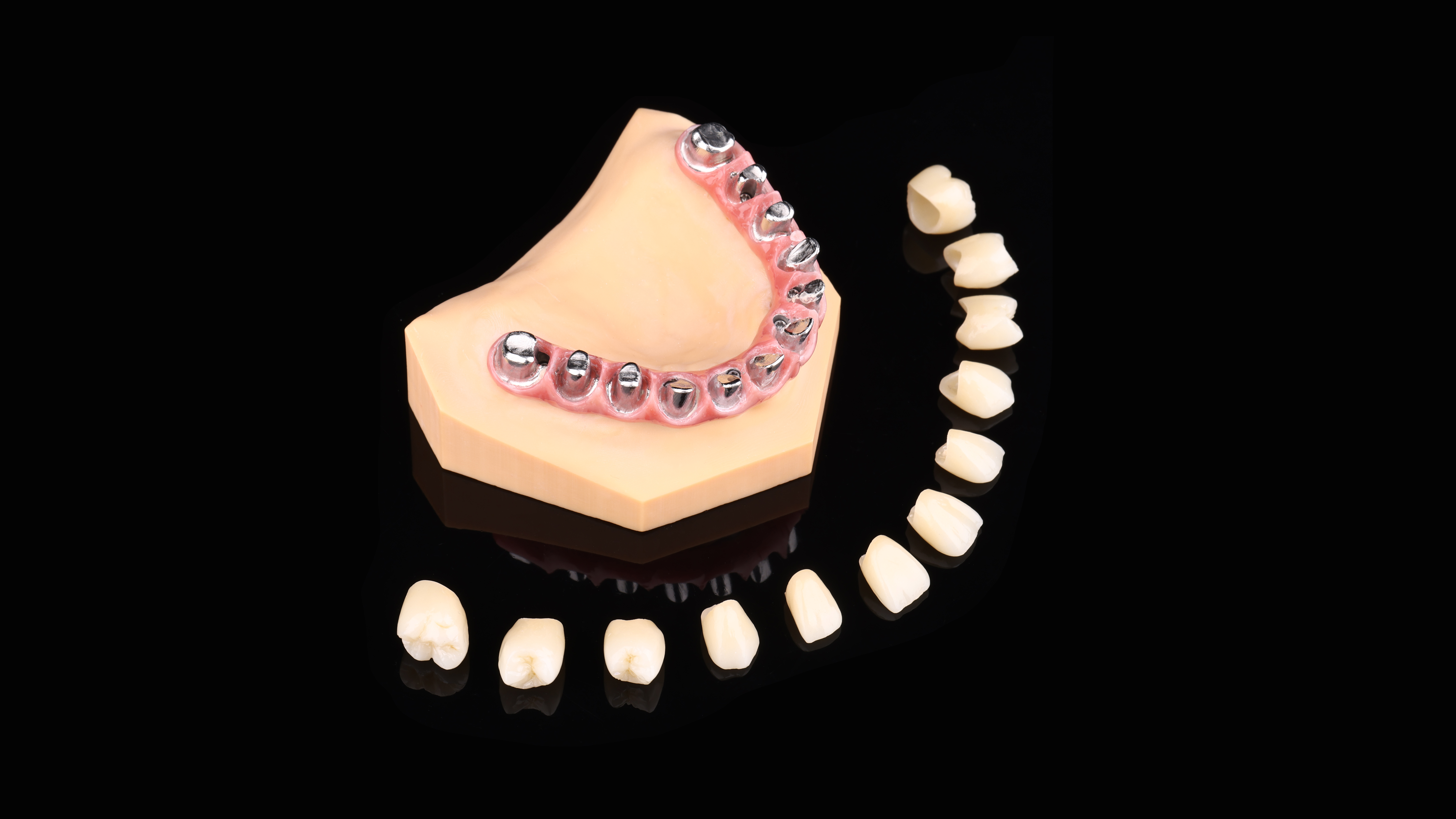 Implant 