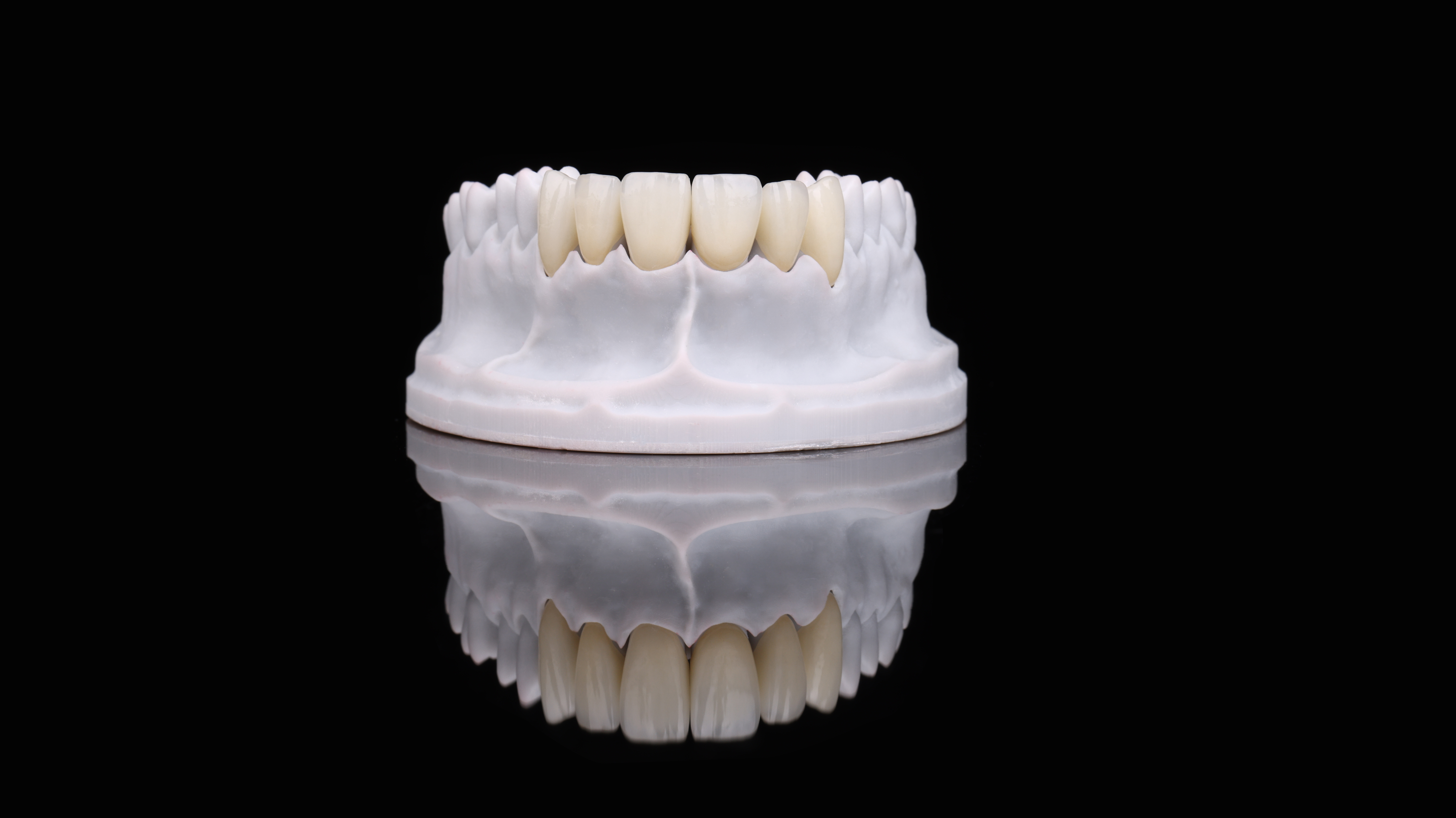 All Ceramic