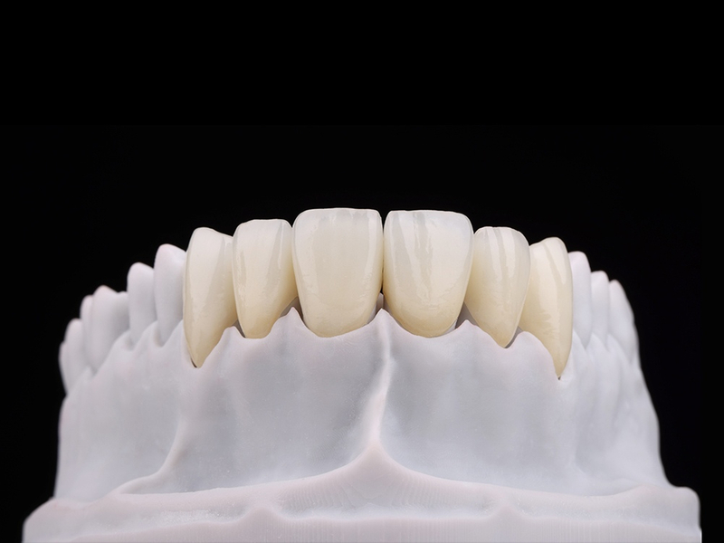 Implant