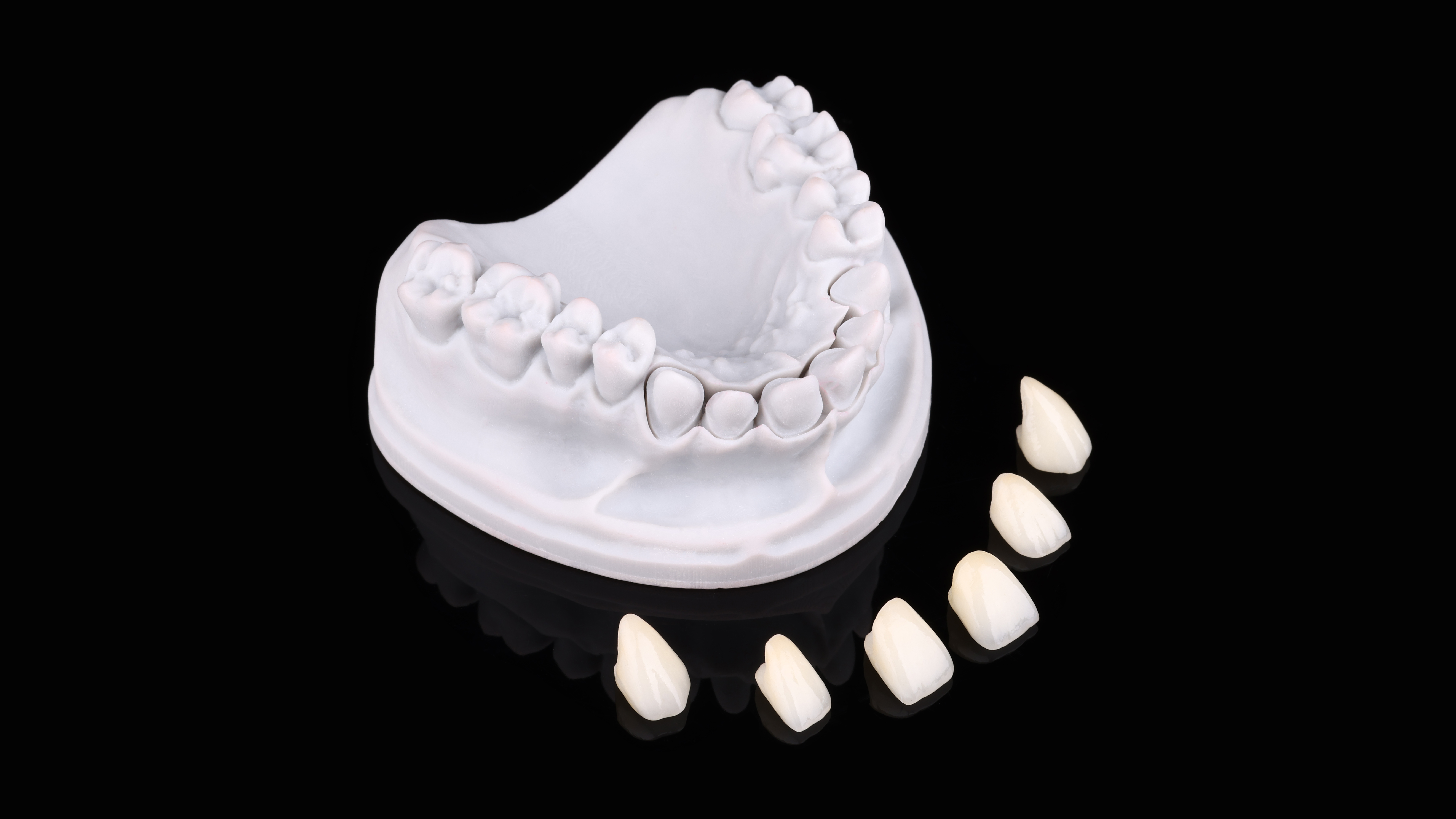 All Ceramic