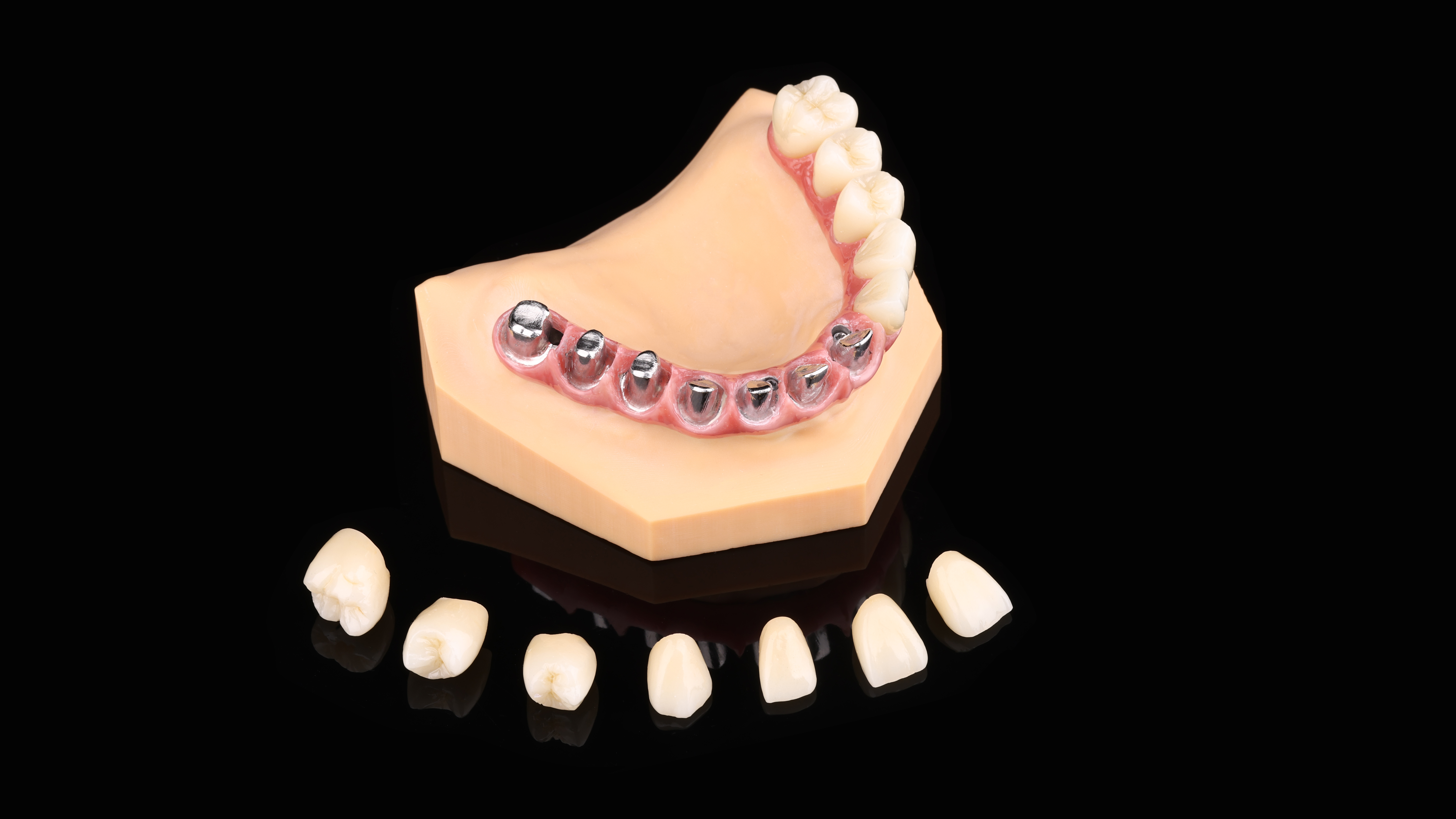 Implant 