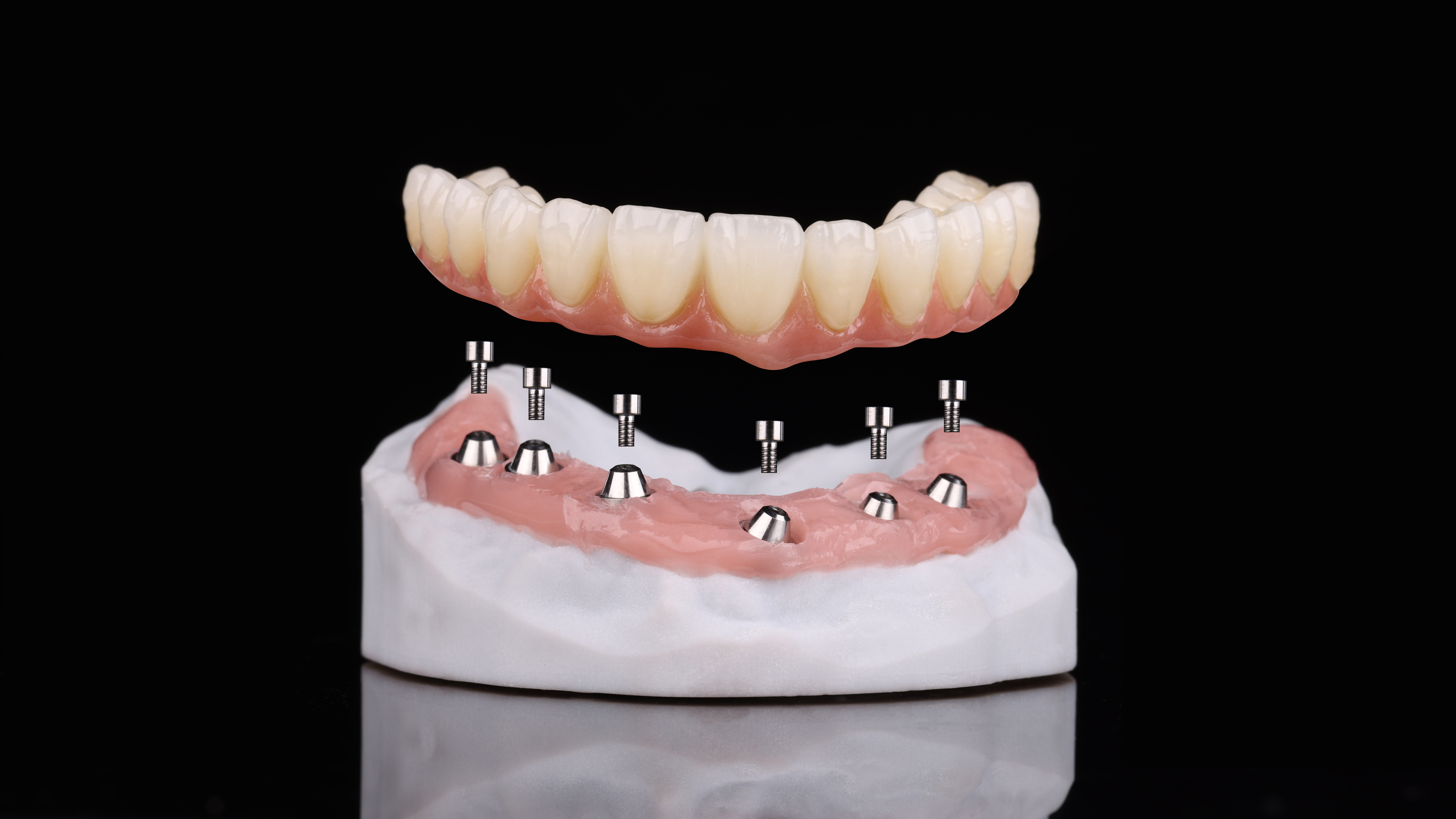 Implant 